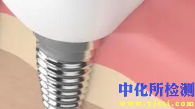 種植體測試
